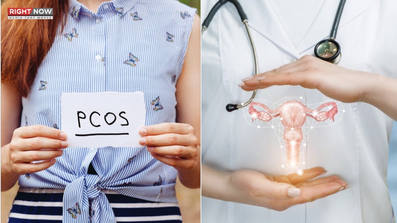 پاکستان میں خواتین میں پولی سسٹک اووری سنڈروم عام، ماہرین کا انتباہ