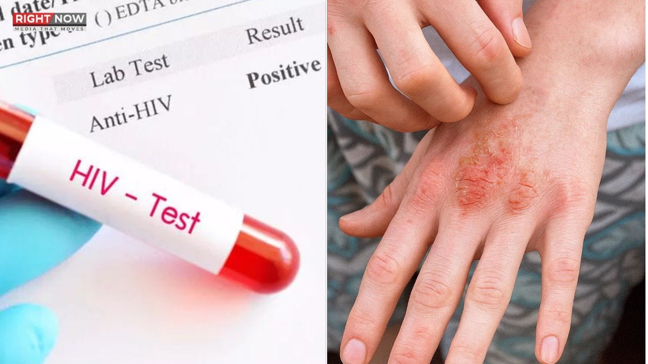 خیبرپختونخوا میں ایچ آئی وی کے کیسز میں 1276 کا اضافہ