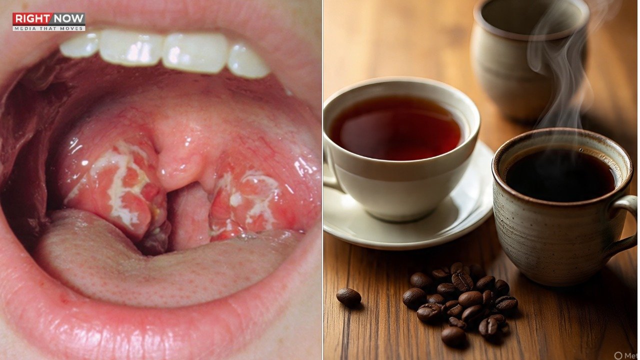 گرم چائے اور کافی کے زیادہ استعمال سے گلے کا کینسر ممکن