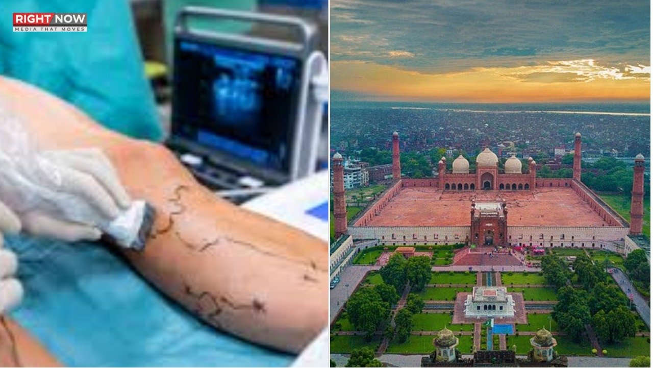 پنجاب میں جدید انٹراویسکولر سرجری تکنیک کا متعارف