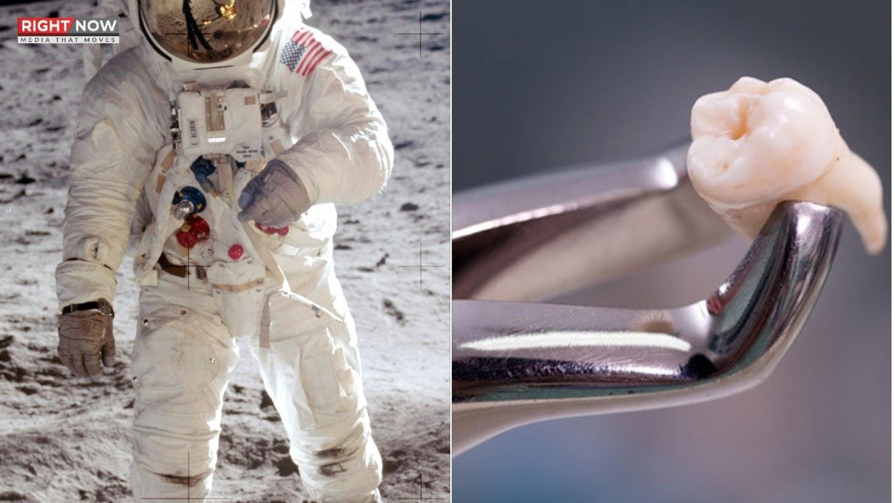 خلا بازوں کی عقل داڑھ کیوں نکالی جاتی ہے؟