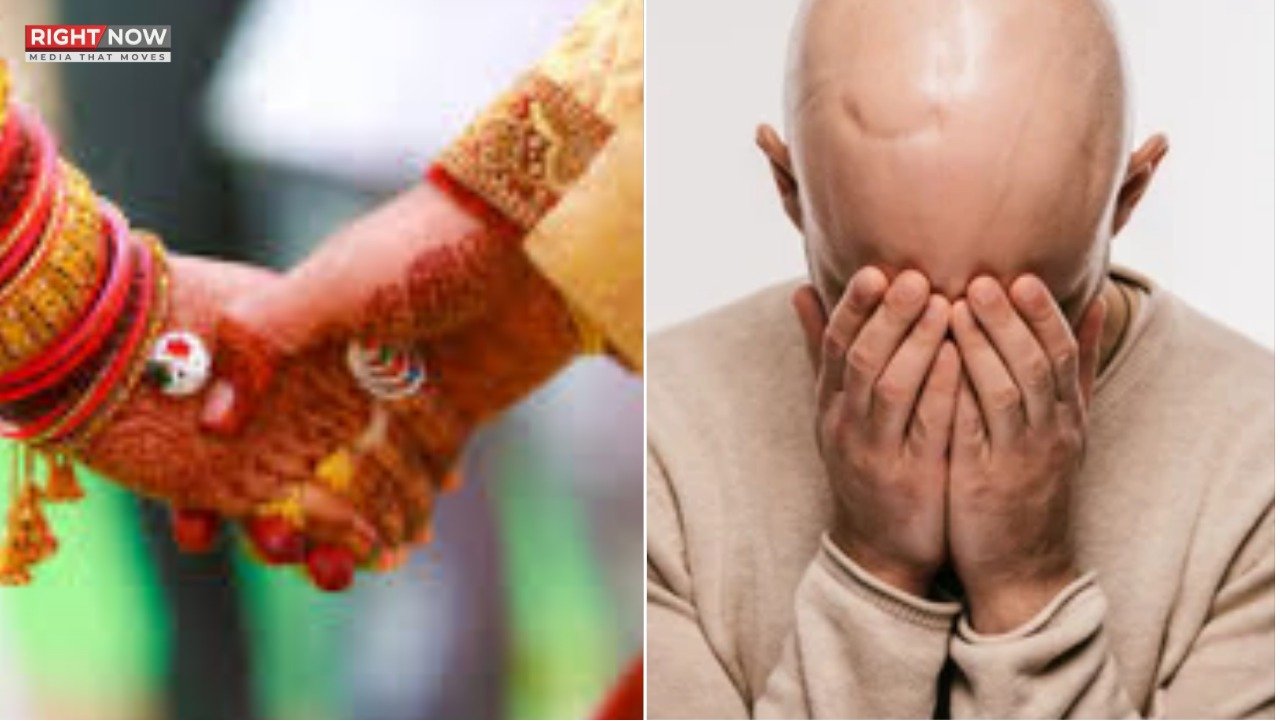 بھارتی خاتون نے شوہر کے گنج پن پر دھوکہ دہی کی ایف آئی آر درج کرائی