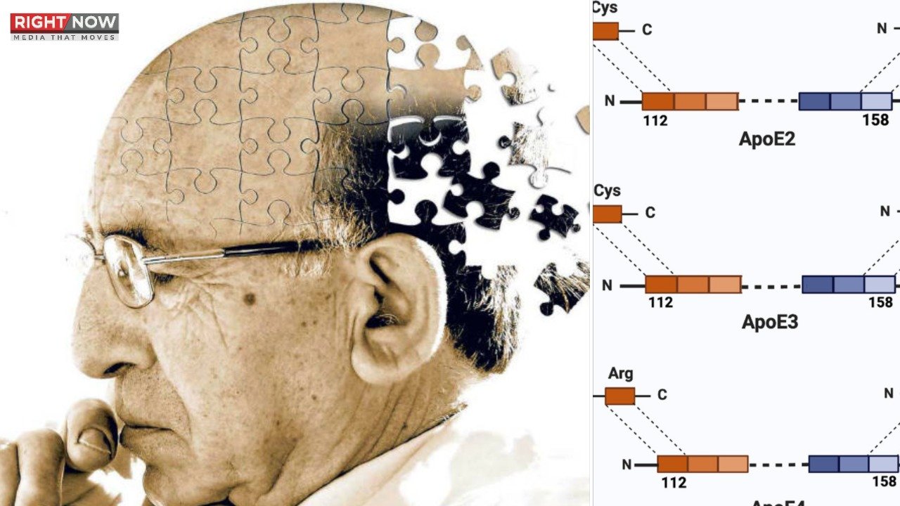 الزائمرز کا ایک جین سے تعلق، نئی تحقیق میں انکشاف