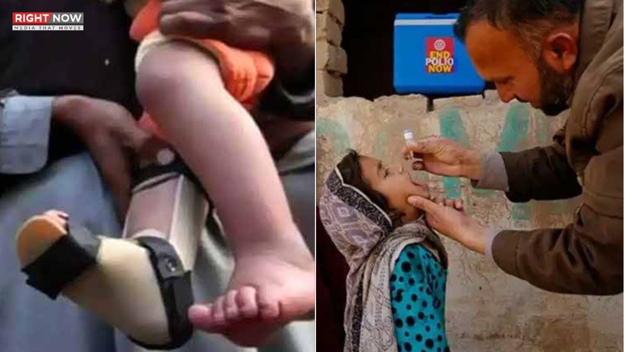 شمالی وزیرستان میں پولیو کا کیس، 2025 میں تعداد 31 ہو گئی