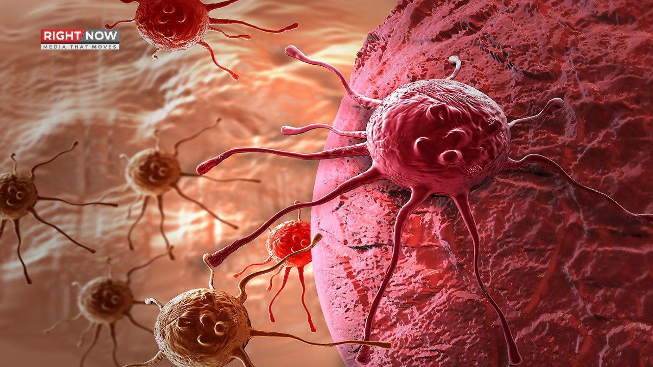 کینسر کی واپسی کے راز کا انکشاف، نیا علاج دریافت