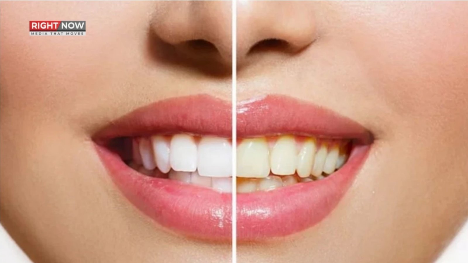 چینی سائنس دانوں کا دانتوں کو محفوظ سفید کرنے والا پاؤڈر تیار