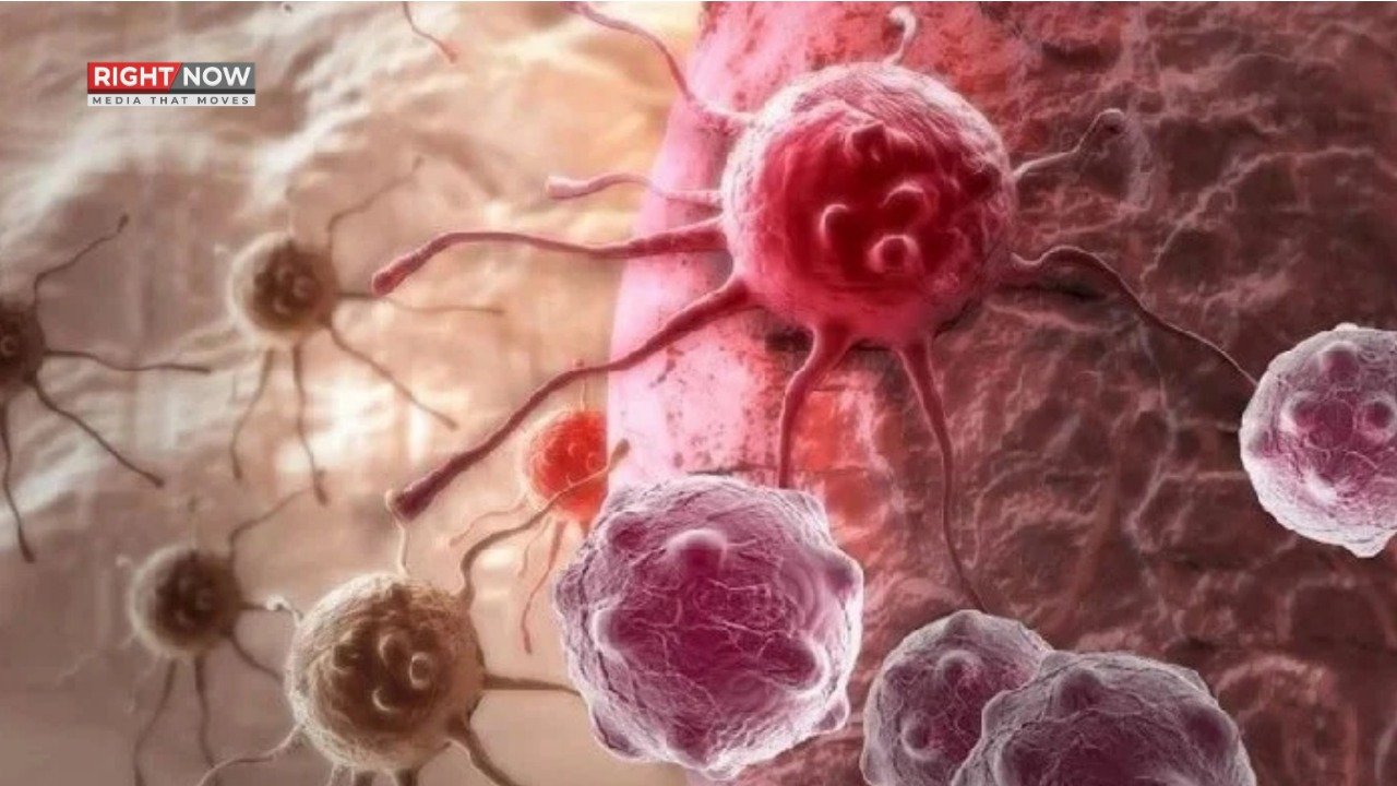 کینسر کے خطرے کی 10 عام وجوہات جو آپ کو جاننی چاہئیں