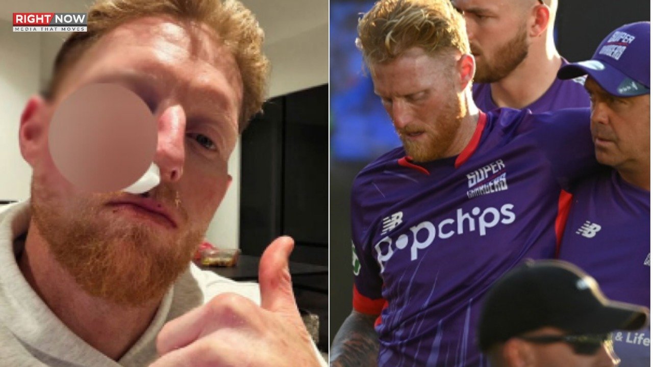 انگلش کپتان بین اسٹوکس گیند لگنے سے زخمی، آرام کی ضرورت