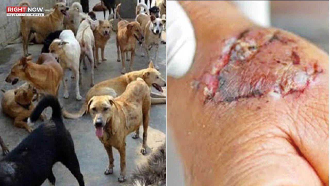 کراچی میں آوارہ کتوں کی دہشت، 6 سگ گزیدگی کے واقعات