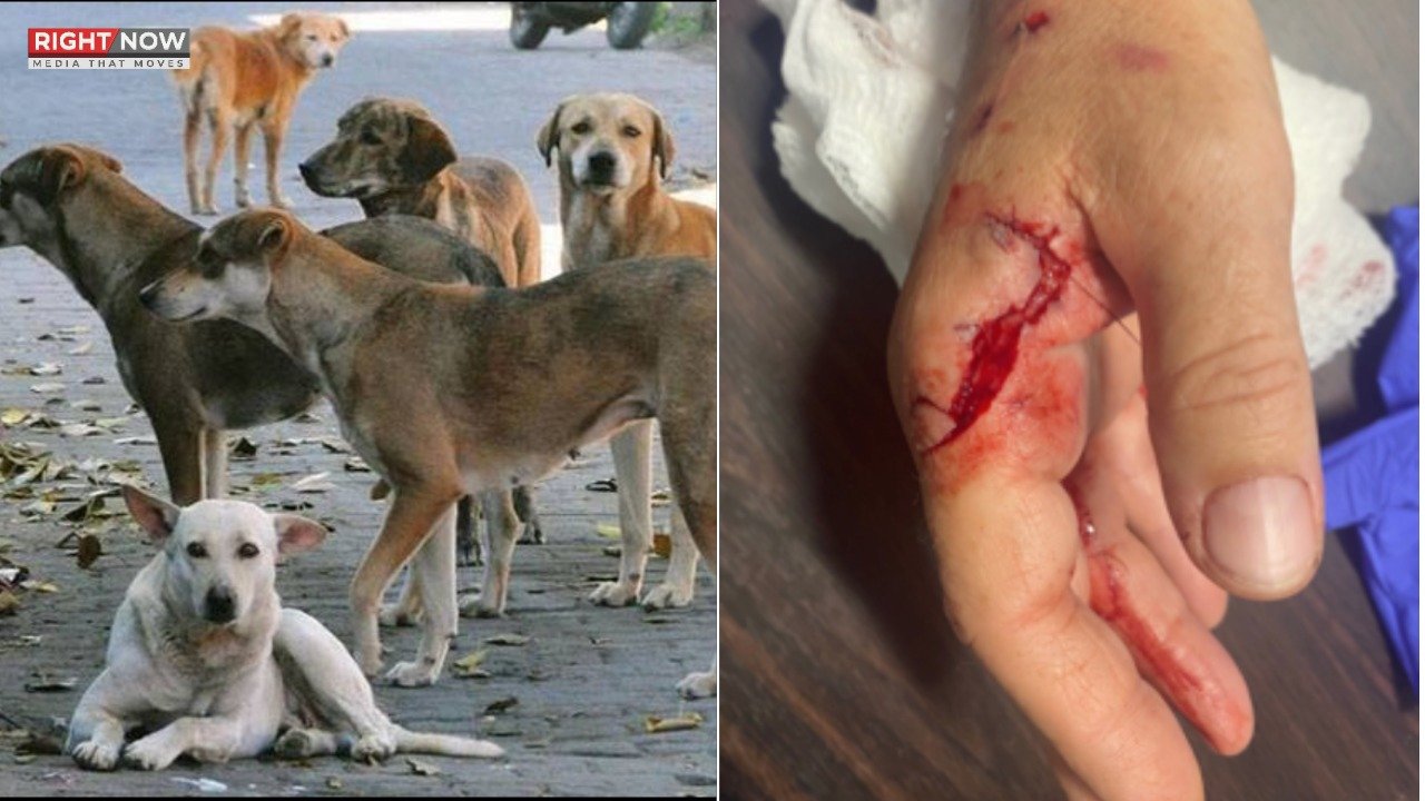 کراچی میں آوارہ کتوں کے حملے سے 10 سالہ طالبہ زخمی