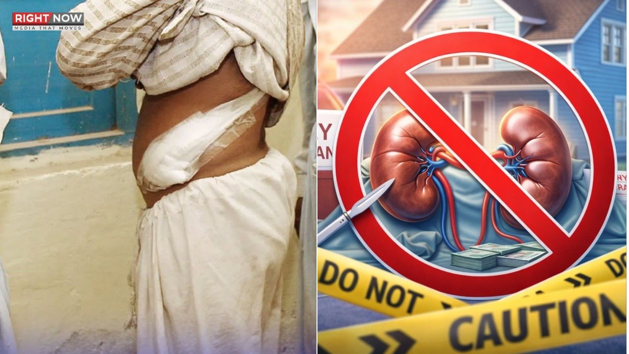 اسلام آباد میں گردوں کی غیر قانونی پیوندکاری پر چھاپہ