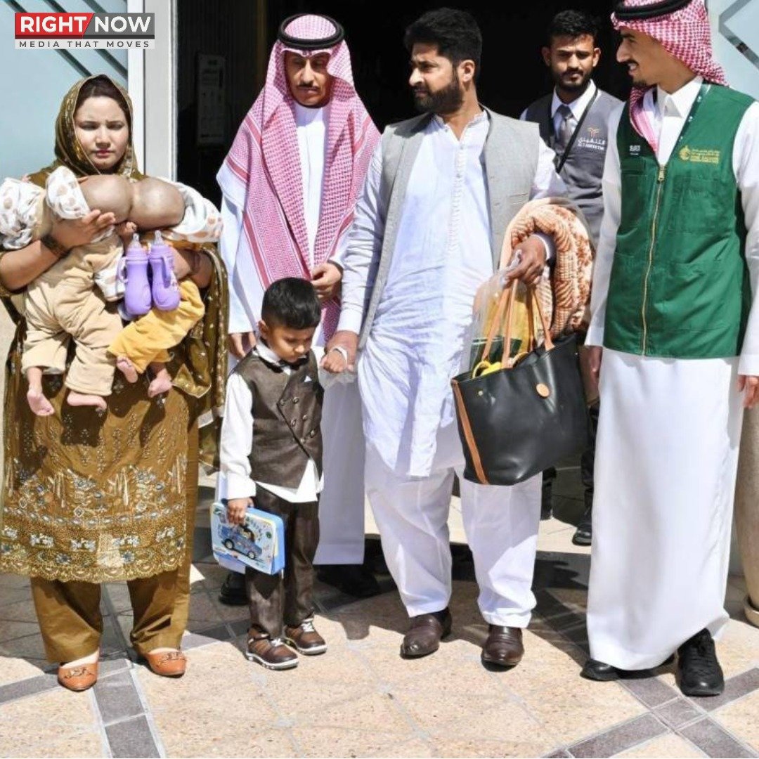 پاکستانی جڑواں بچوں کی ریاض میں علیحدگی کی سرجری کی تیاری