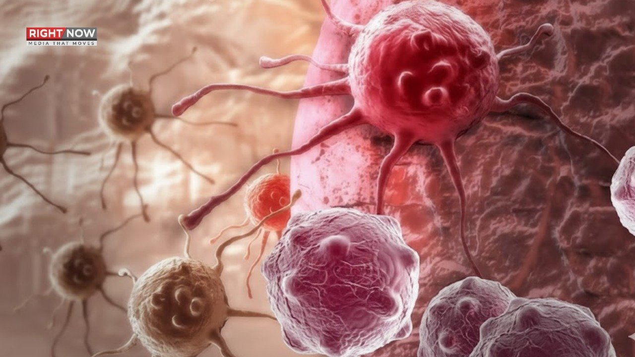 جوان افراد میں کینسر کے 6 اقسام کا تیزی سے بڑھتا خطرہ