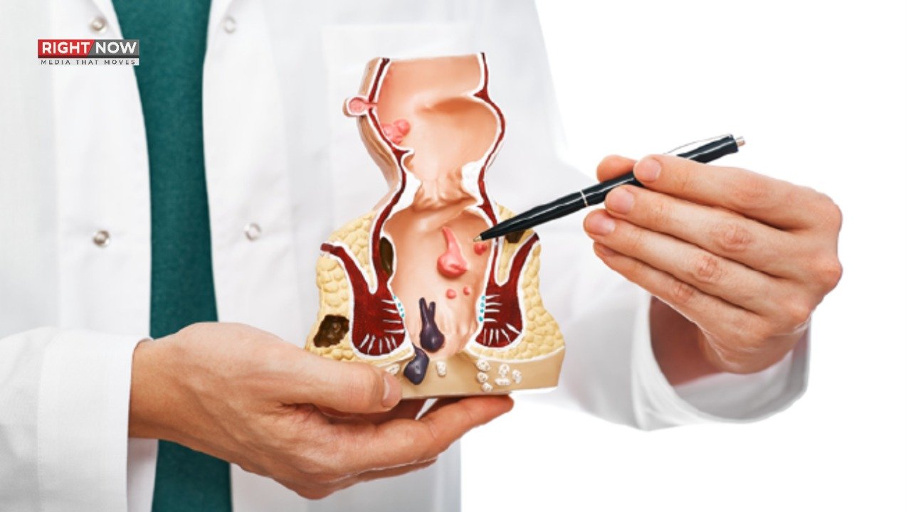 بواسیر کے مریضوں کے لیے روزے کے احکام