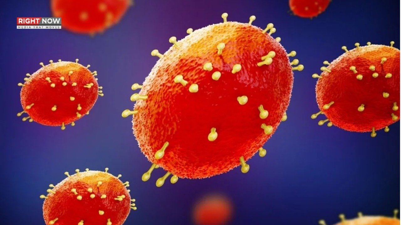 خیرپور، منکی پاکس کی وبا کی وفاقی تحقیقات شروع