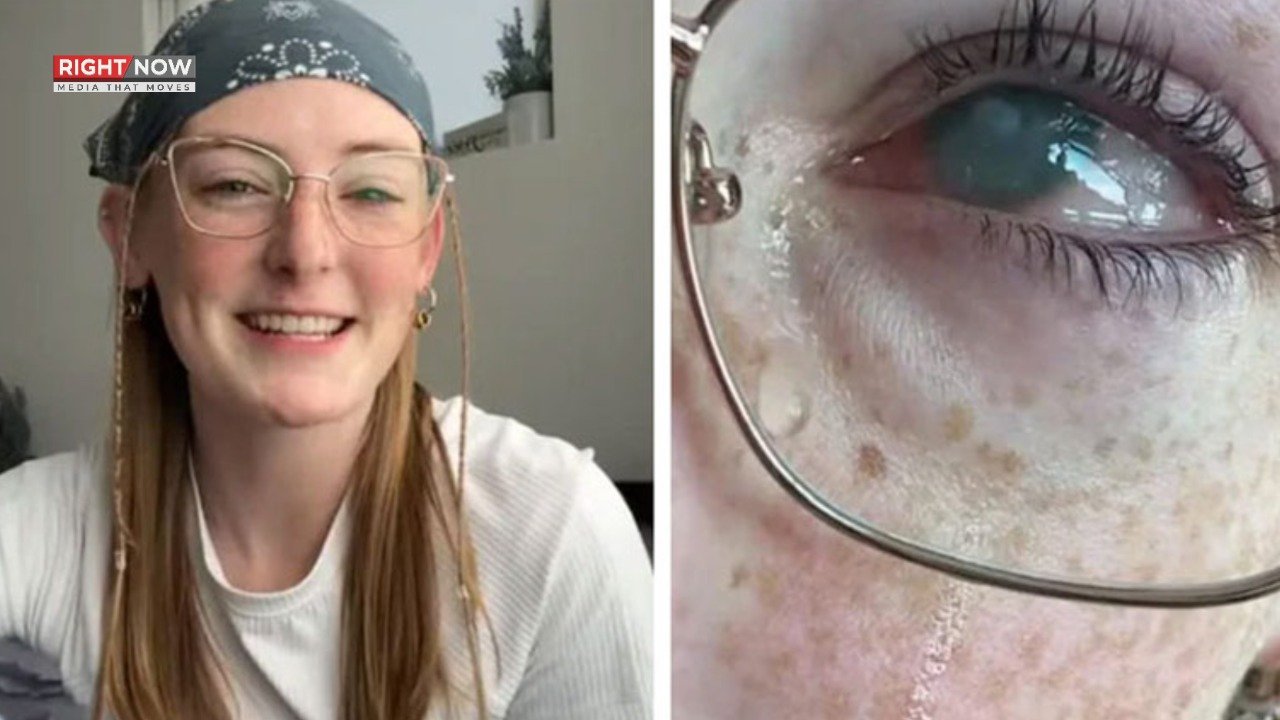 گریس جیمیسن، کانٹیکٹ لینس کے غلط استعمال سے بینائی کھو بیٹھی