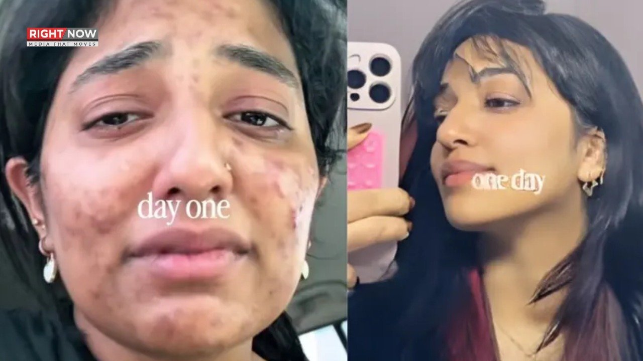 دبئی کی خاتون کی جلد کی حیران کن تبدیلی، ویڈیو وائرل