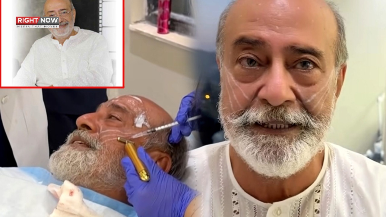 محمد احمد کی فیس لفٹ پر وضاحت، بالی وڈ پلاسٹک سرجری سے انکار