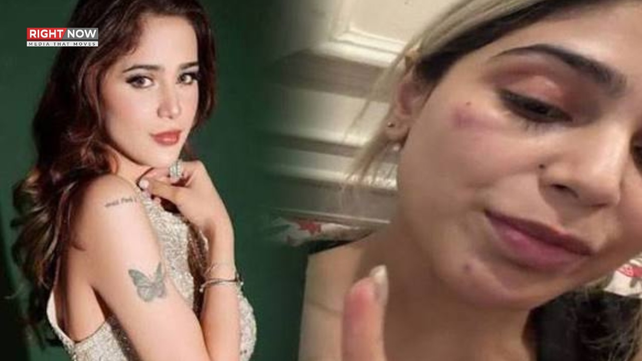گلوکارہ آئمہ بیگ حادثے میں زخمی، چہرے پر نیل پڑ گیا
